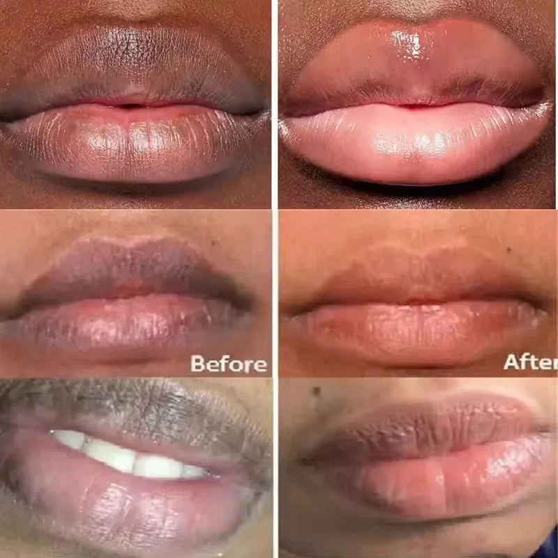 Remove Dark Lip Balm Fast Lightening Pink Lip Exfoliating Fade Lip Line Dead Skin Moisturizer Korean Care Products Beauty Health