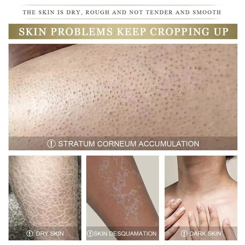 Reduce Chicken Skin Cream Repair Acne Hair Follicles Shrink Pores Fade Body Melanin Whiten Smooth Moisturize Skin Beauty Health