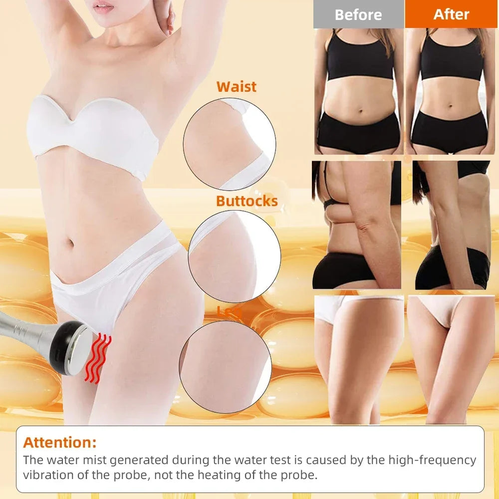 Missheart 4 In 1 Cavitation Ultrasonic Body Slimming Machine Beauty Device