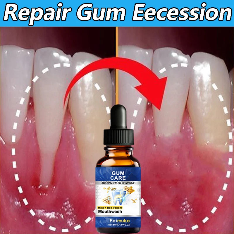 Repair Damaged Gums Essence Relieve Sensitive Gums Atrophy Swelling Reduce Bleeding Halitosis Whiten Teeth Improve Oral Health