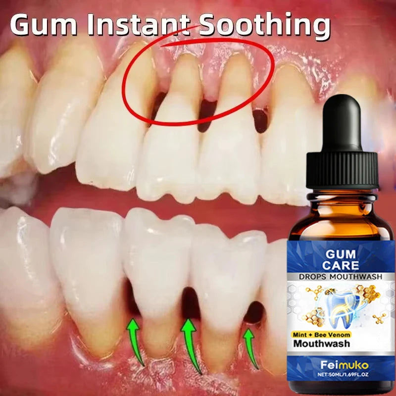 Repair Damaged Gums Essence Relieve Sensitive Gums Atrophy Swelling Reduce Bleeding Halitosis Whiten Teeth Improve Oral Health