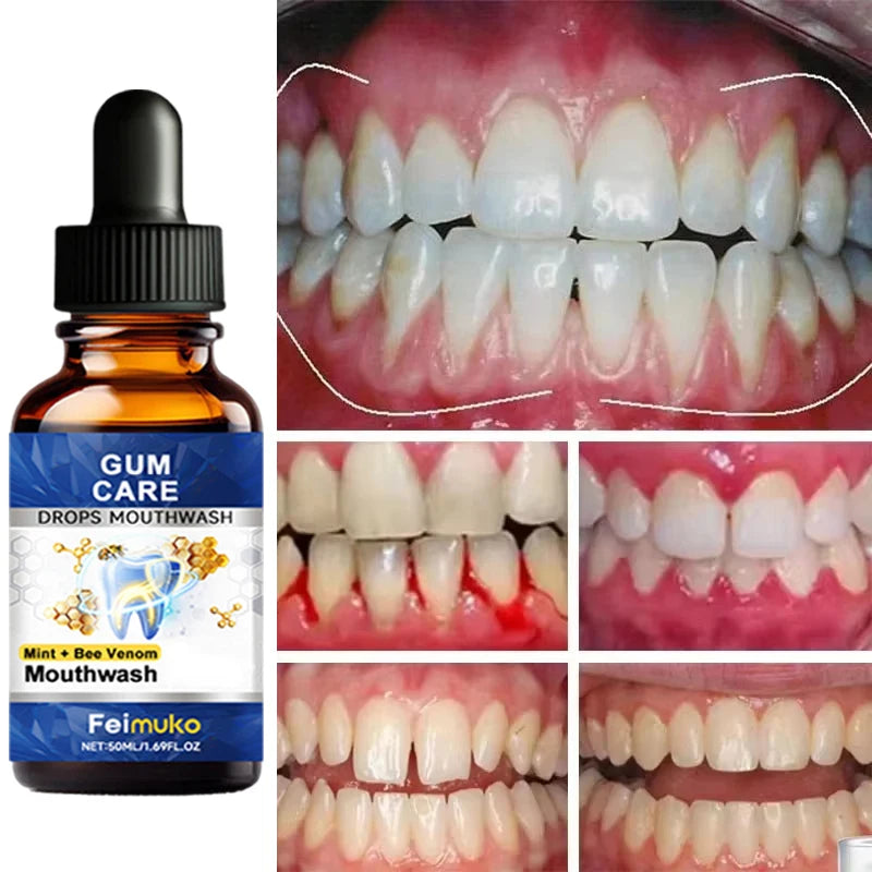 Repair Damaged Gums Essence Relieve Sensitive Gums Atrophy Swelling Reduce Bleeding Halitosis Whiten Teeth Improve Oral Health