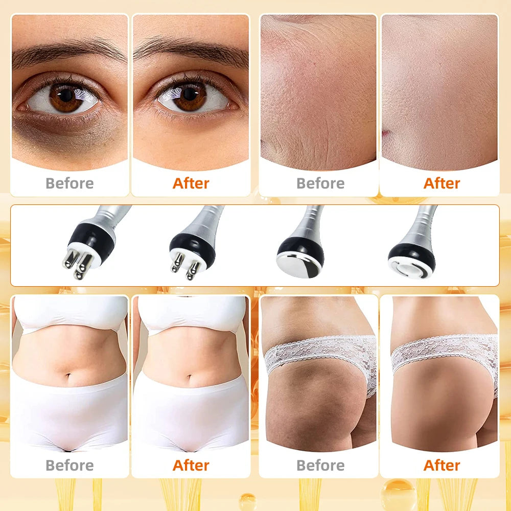 Missheart 4 In 1 Cavitation Ultrasonic Body Slimming Machine Beauty Device